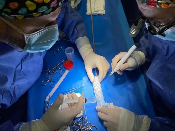 El Hospital Clínico de Zaragoza utiliza tecnología 3D para crear prótesis aórticas