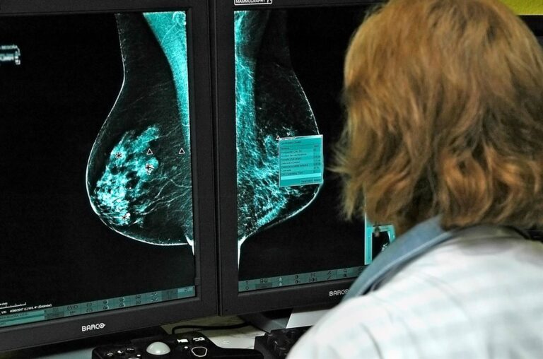 Oncólogos andaluces analizan el plan para recuperar la confianza en el programa de cáncer de mama