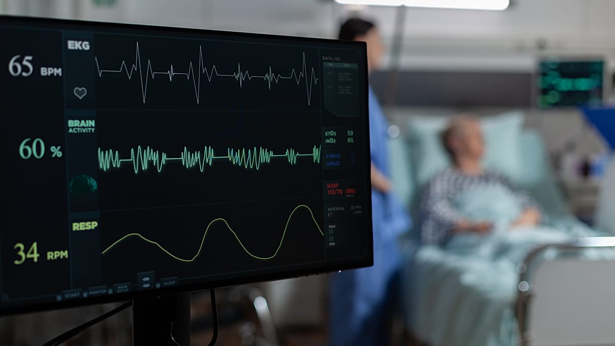 La carga cardiovascular en Europa: casi 2 millones de muertes y 282.000 millones de euros anuales