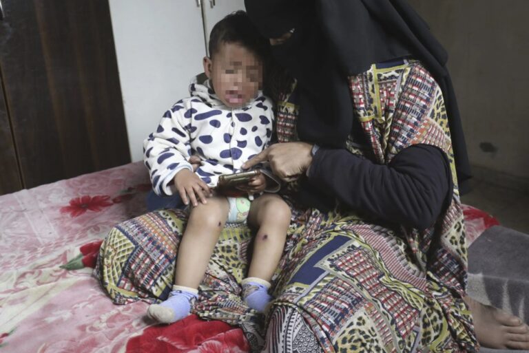 Bebé de Gaza sufre lesiones y quemadura tras ser detenido por Israel, informa su familia