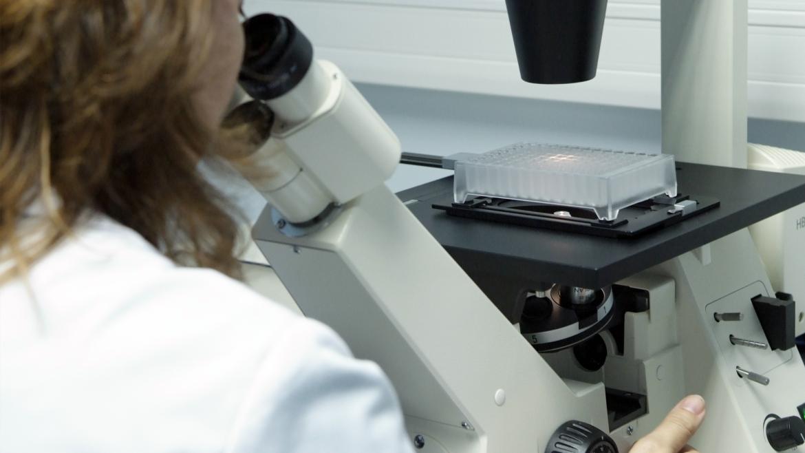 El hospital Gregorio Marañón impulsa un estudio sobre una nueva terapia para el cáncer de pulmón