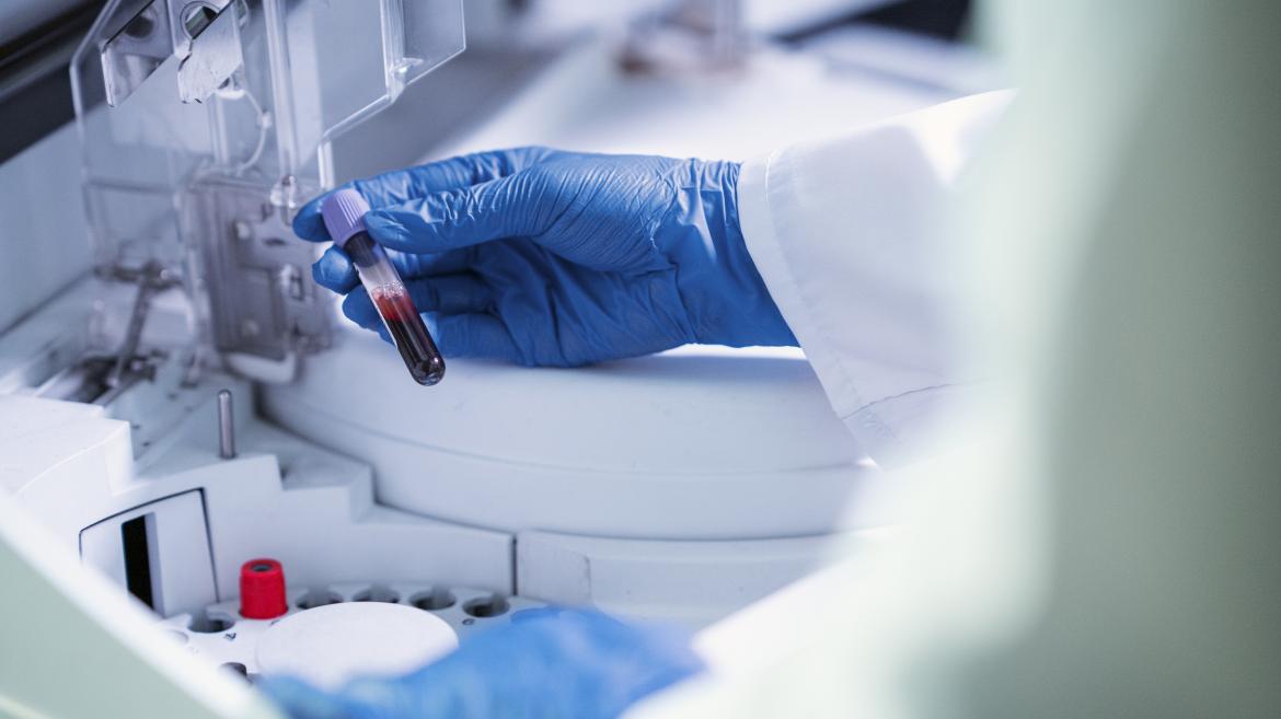 El hospital Ramón y Cajal destaca por su proyecto innovador para pacientes de terapia celular